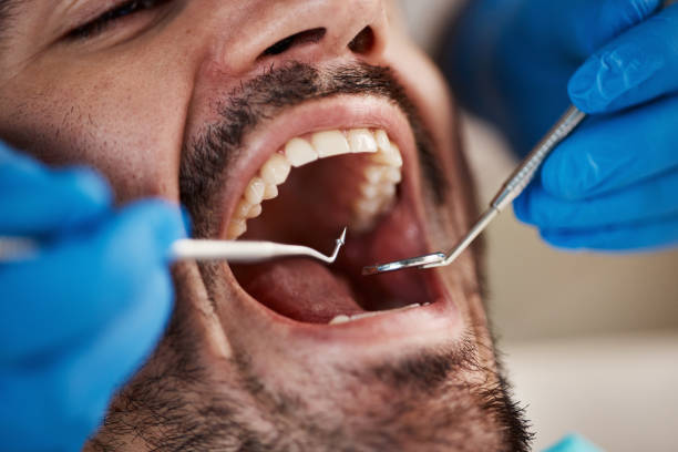 Best Knocked-Out Tooth Emergency  in Chapel Hill, NC